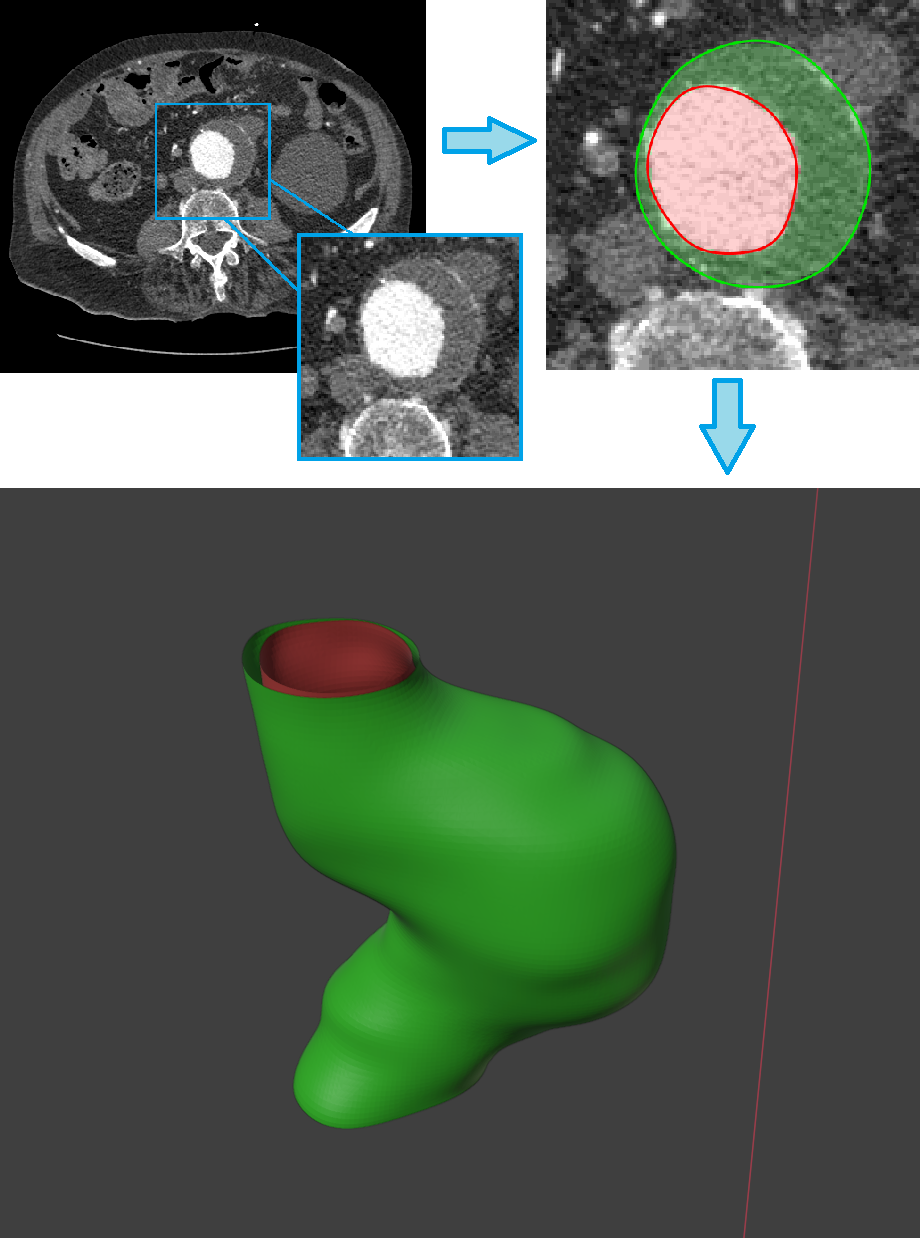 Jak matematické modelování pomáhá medicíně