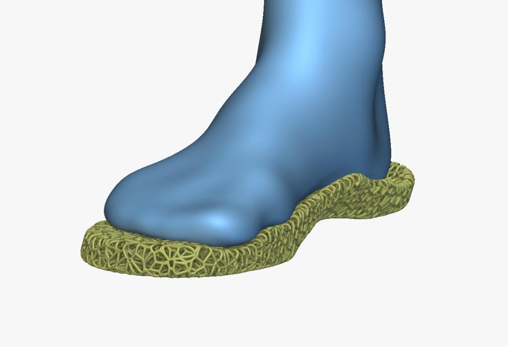 3D tisk na VŠB-TUO nachází uplatnění v medicíně. Od dentálních modelů po ortopedické vložky